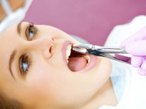 Vađenje zubi